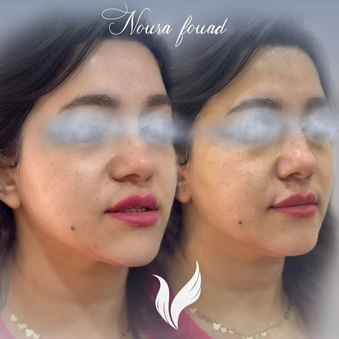 Prevention & Radiance treatment