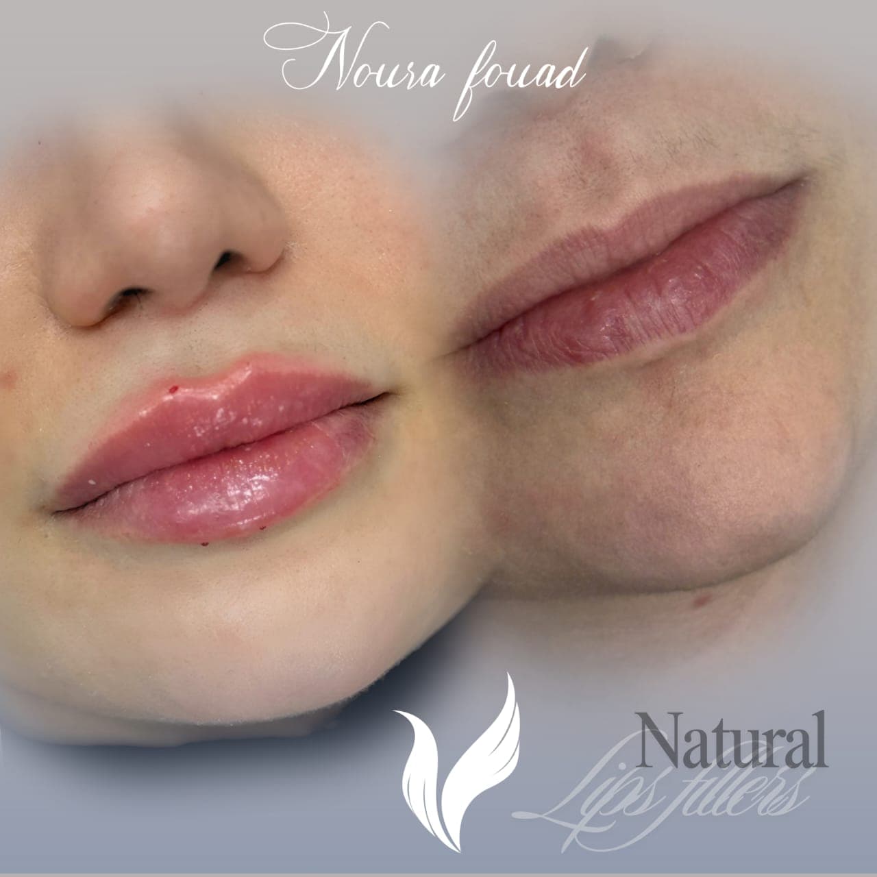 Transformation & Renewal treatment